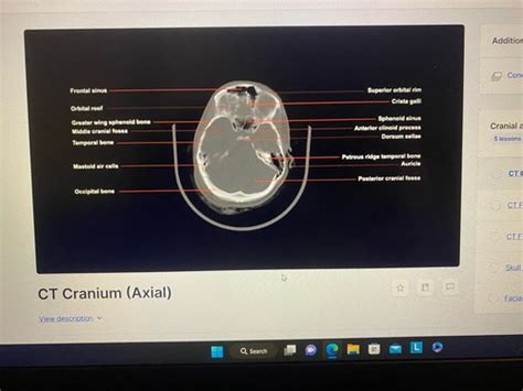 Ct Anatomy Pathology Labeling Flashcards Quizlet