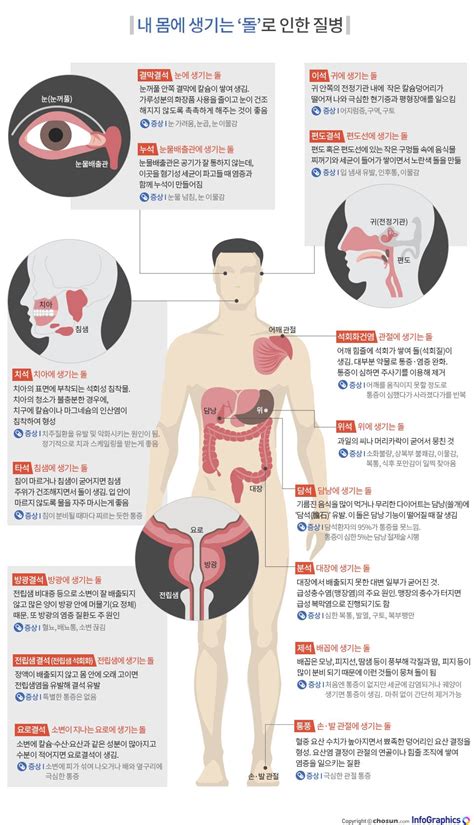 인포그래픽에 있는 핀