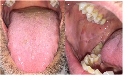 Dentistry Journal Free Full Text Oral Healthcare And Idiopathic