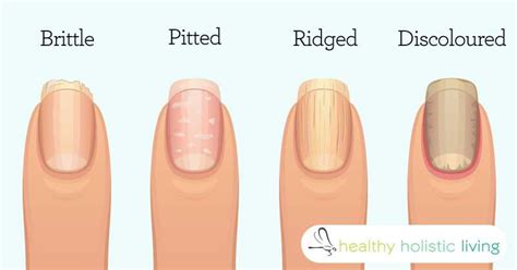 8 Warning Signs From Your Fingernails About Your Health