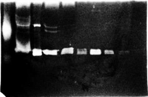 Amylase Zymogram Using Starch As Substrate Active Fractions From