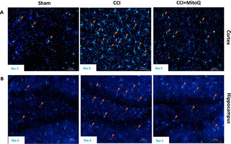 iba  promising marker  traumatic brain injury