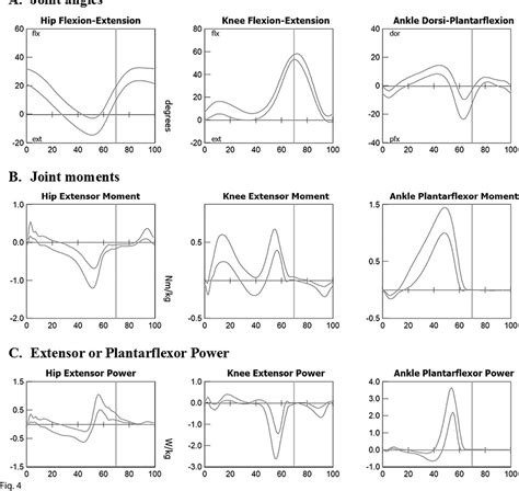 Figure 4 From Instrumented Gait Analysis A Tool In The Treatment Of