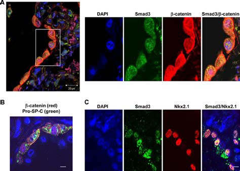 Co Localization Of Catenin With Smad In Hyperplastic At Cells Of