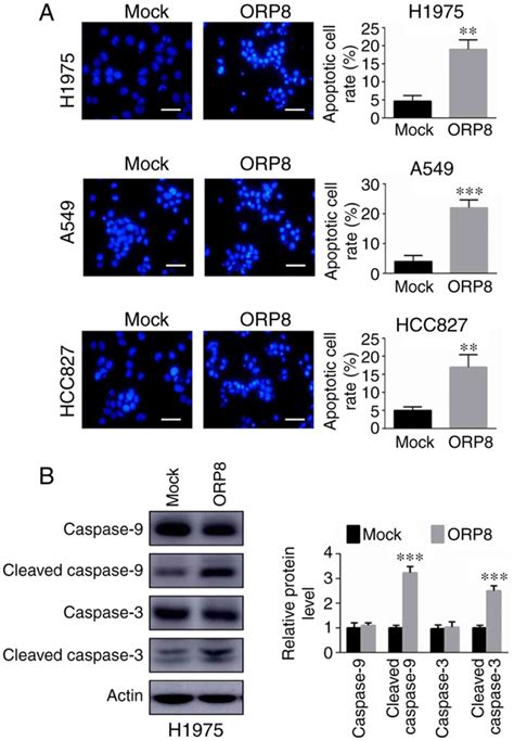 ORP8 Induces Apoptosis By Releasing Cytochrome C From Mitochondria In