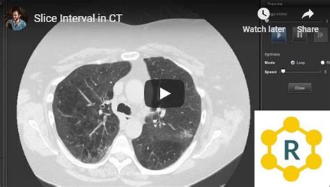 Slice Thickness And Interval Explained