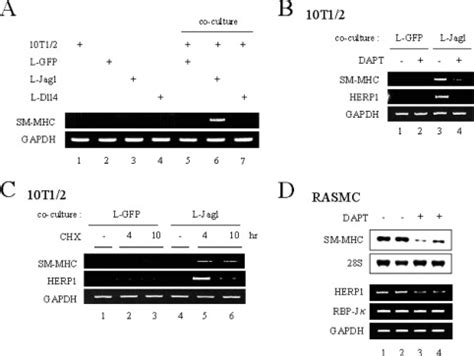 Jagged1 Selective Notch Signaling Induces Smooth Muscle Differentiation