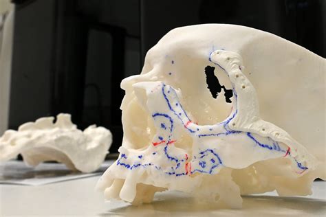 Chapitres De La Sfscmfco Soci T Fran Aise De Stomatologie Chirurgie