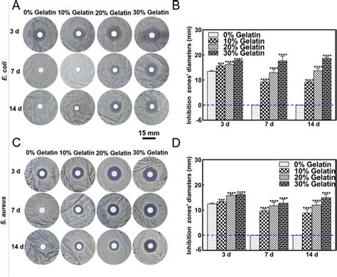 Antibacterial Ability Of Pmma Bone Cement With Different Proportions Of