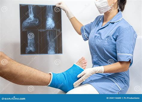 Bone Fracture Foot And Leg On Male Patient Being Examined By A Woman