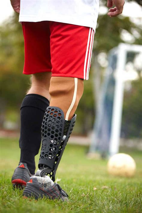 Now You Can Buy Prosthetic Leg With Real Style Appeal
