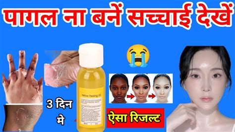 Tsuyui Oil Skin Whitening Yellow Peel Reviewyellow Peeling Oil 2025