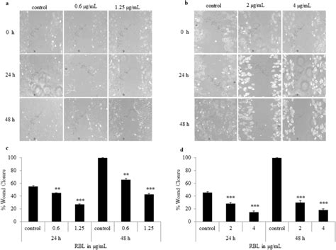 Rbl Inhibits Skov3 And Ovcar3 Cell Motility Wound Healing Assay Was