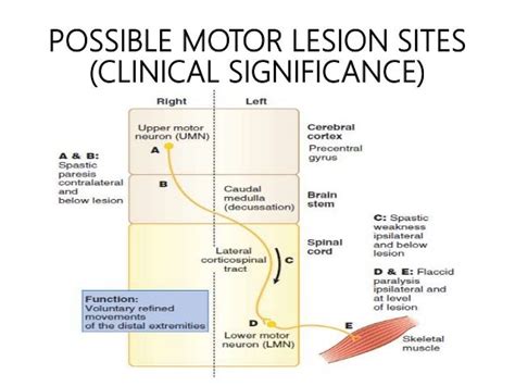 Upper And Lower Motor Neuron Lesions