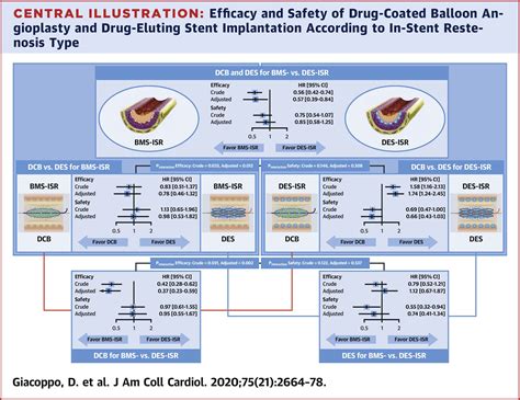 Drug Coated Balloon Angioplasty Versus Drug Eluting Stent Implantation