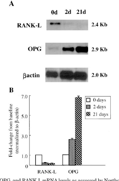 Figure 3 From The Expression Of Osteoprotegerin And Rank Ligand And The