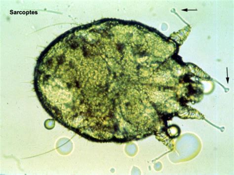 Parasitology Flashcards Quizlet