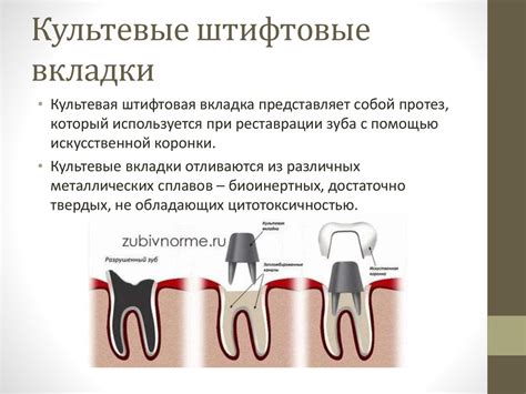 Изготовление штифтовых конструкций в ортопедической стоматологии ...