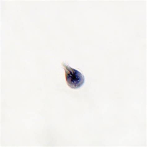 Giardia Lamblia 400x