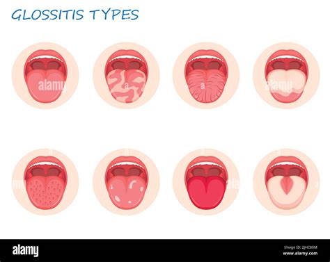 Types of bacteria disease immagini e fotografie stock ad alta risoluzione - Alamy