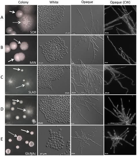 Novel Environmental Cues Induce Filamentation In C Albicans Opaque Download Scientific Diagram