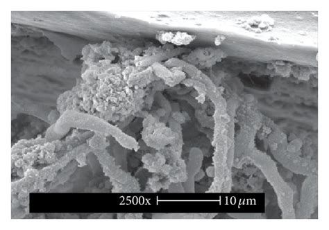 Scanning electron microscopy images of the tip and cuff of the central ...