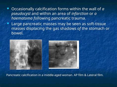 Investigations Biliary For Obstructive Jaundiceppt
