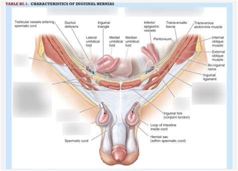 Inguinal Hernias Diagram | Quizlet