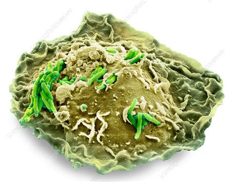 Macrophage Engulfing Tb Bacteria Sem Stock Image C