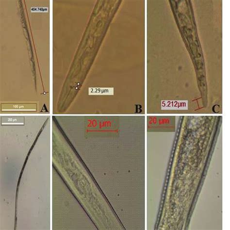 Micrographs of Meloidogyne incognita female (A) Whole body of a female;... | Download Scientific ...