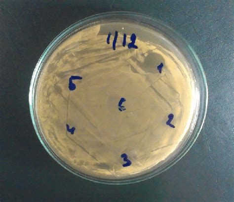 Screening Lactic Acid Bacteria For Survival Under The Different