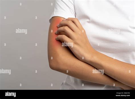 Red Arm Of Person With Allergic Reaction Scratching Itching Skin