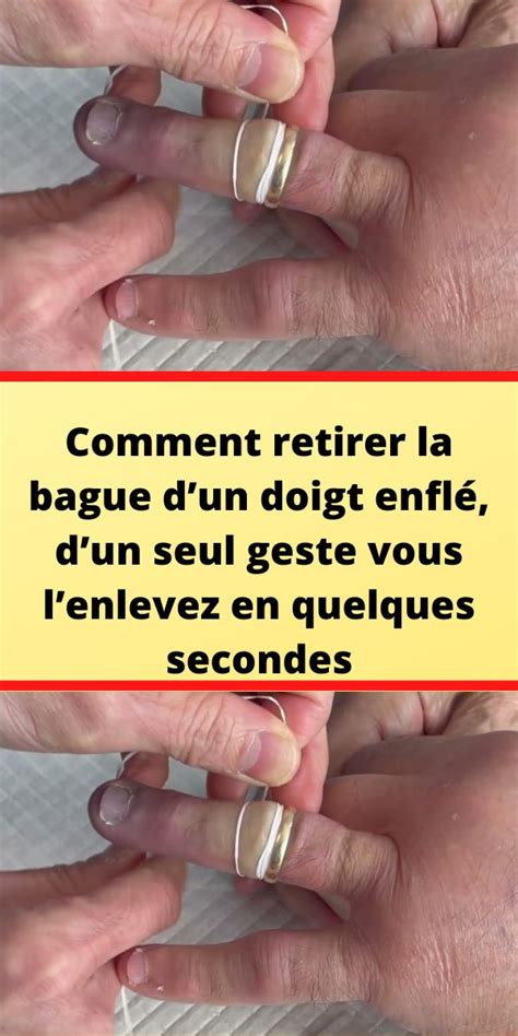 Comment retirer la bague dun doigt enflé dun seul geste vous l