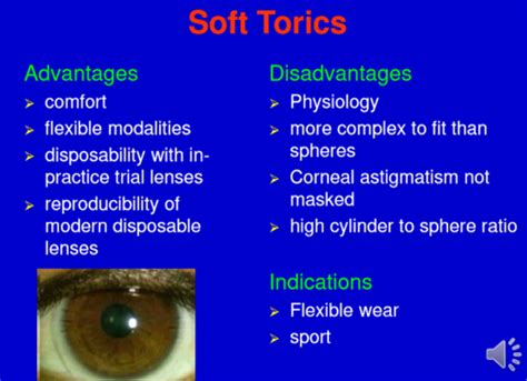 Lecture 15 Soft Toric Contact Lenses Flashcards Quizlet