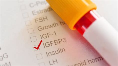 IGF-1 (Insulin-like Growth Factor 1) – GrowTaller.blog