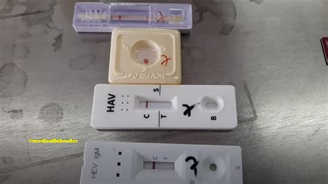 Immunochromatographic Test Ict Introduction Principle Test