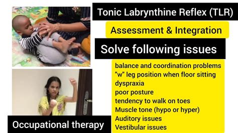 Tonic Labyrinthine Reflex TLR How To Test Integrate TLR Primitive