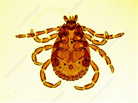 Brown Dog Tick - Stock Image - C028/7179 - Science Photo Library