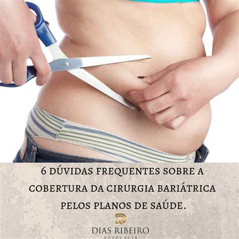 6 dúvidas frequentes sobre a cobertura da cirurgia bariátrica pelos