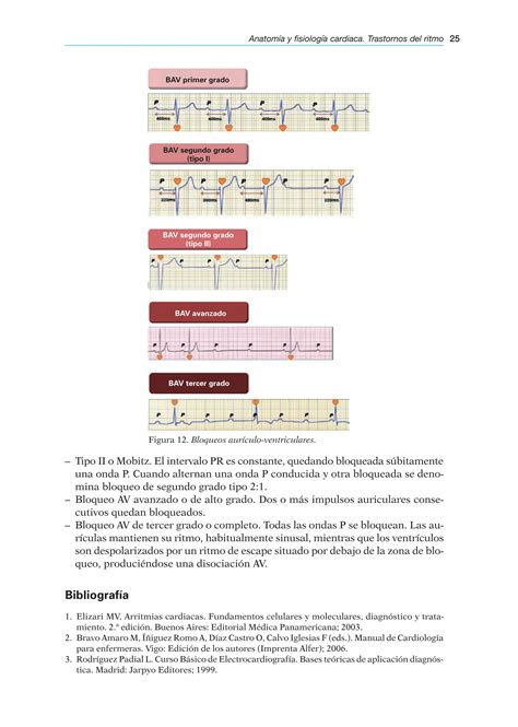 Ritmo Sinusal Normal Y Transtornos Del Ritmo Pdf