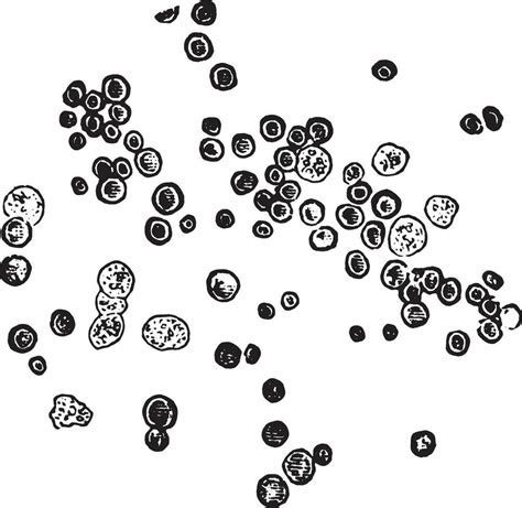 Types of red blood cells, also leukocytes, vintage engraving. 35466075 ...