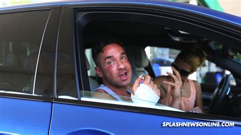 Mike The Situation Sorrentino Huge Shiner After Arrest In Tanning