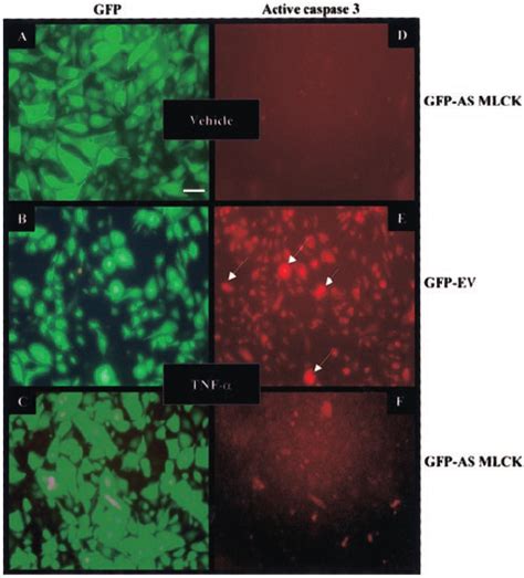 Reduction In Ec Mlck Expression Decreases Tnf ␣ Induced Endothelial