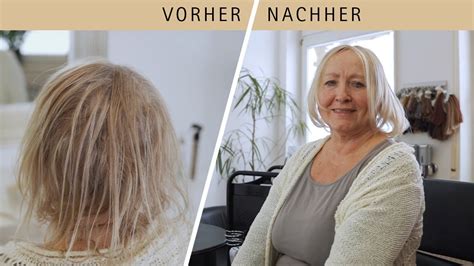 Endlich Wieder Volles Haar Mit Einem Haarsystem Hairsystem