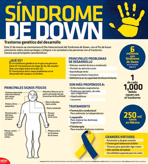 Hoy Tamaulipas Infografía Síndrome De Down Trastorno Genético Del