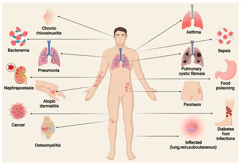 Toxins Free Full Text Exploring The Role Of Staphylococcus Aureus