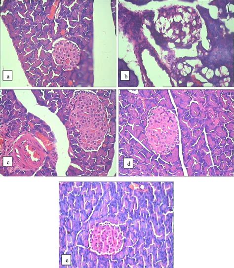 Histopathological Study Of Pancreas Tissues Of Normal Control Stz