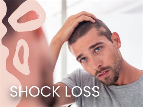 Shock Loss After Hair Transplant Definition Causes Symptoms