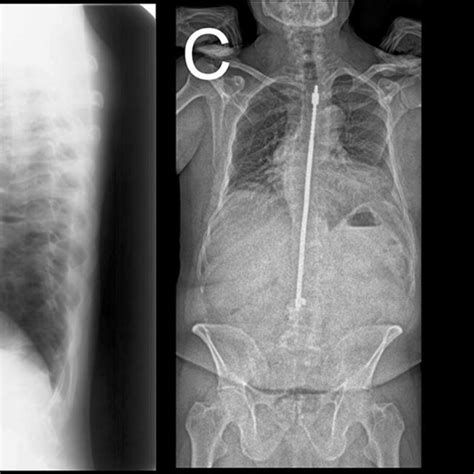 Conventional Radiographs Of A Surgically Treated Patient With Download Scientific Diagram