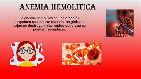 Anemia Hemol Tica Milk Cuellar Udocz